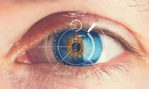 هزینه عمل لیزیک چشم در بیمارستان نور