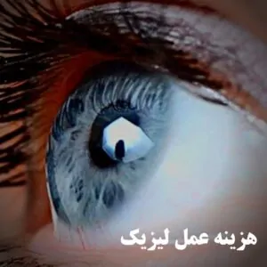 عمل لیزیک چشم چقدر هزینه دارد